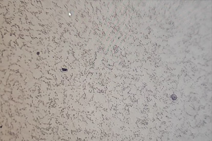 Goldener Detektion-500 mal goldener Test